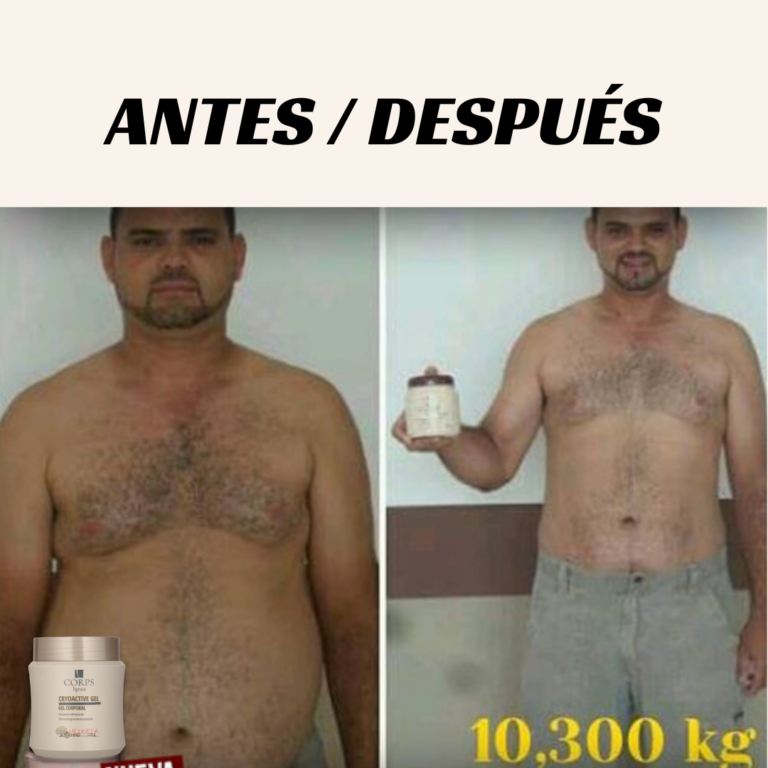 ANTES-DESPUES-4.png