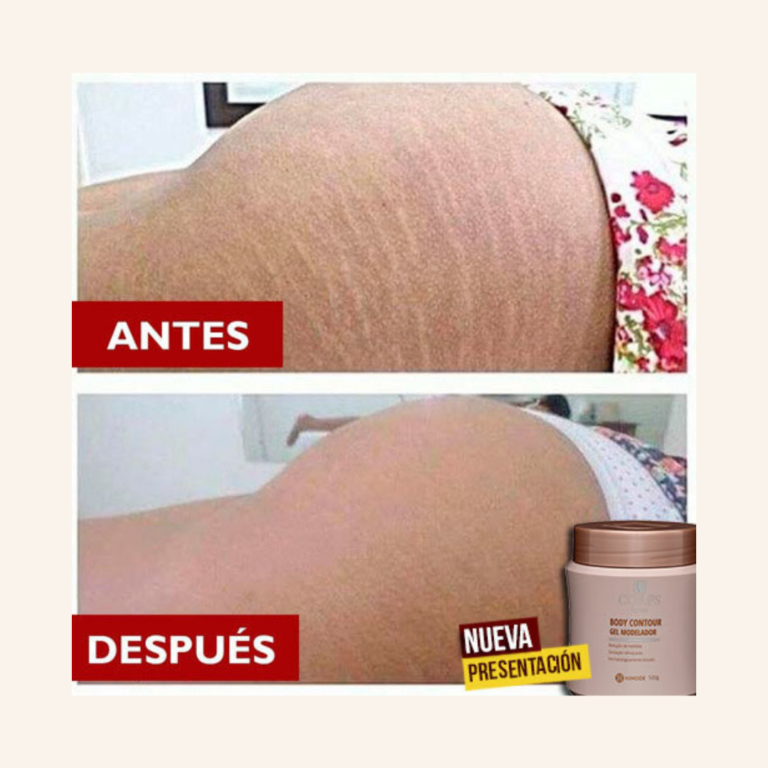 ANTES-DESPUES-6-1.png